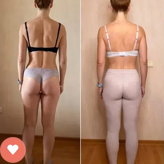 Member before and after