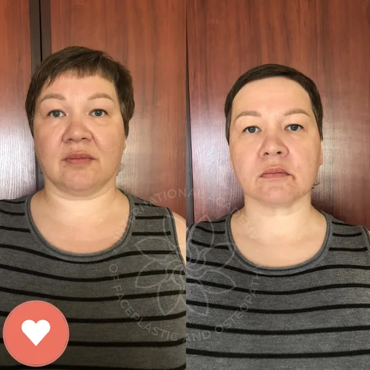 Member before and after