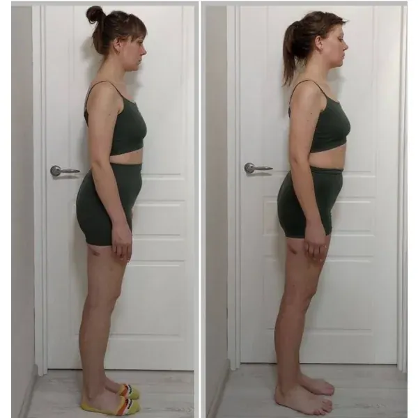 Before and after — taller posture