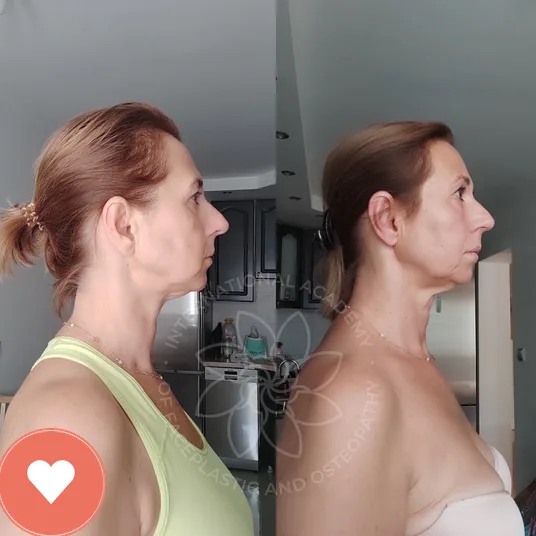 Member before and after