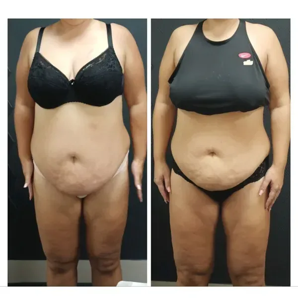 Member before and after