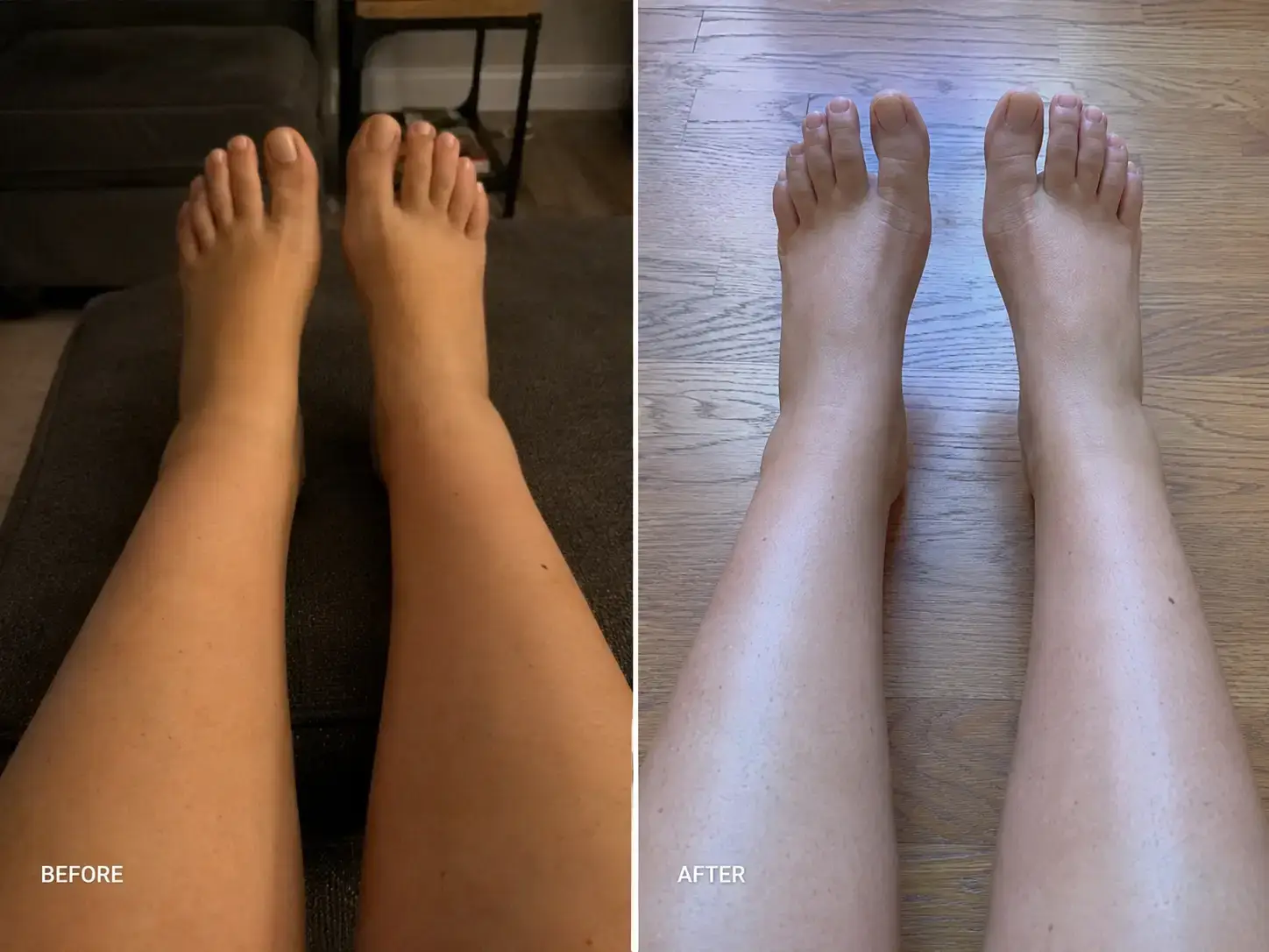 Before and after — less swelling