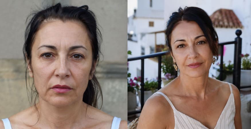 Antes · Después