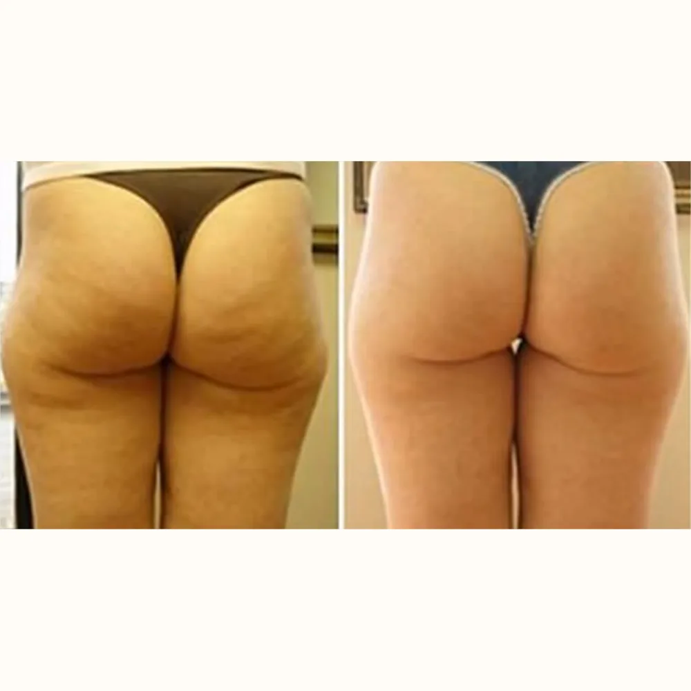 Member before and after