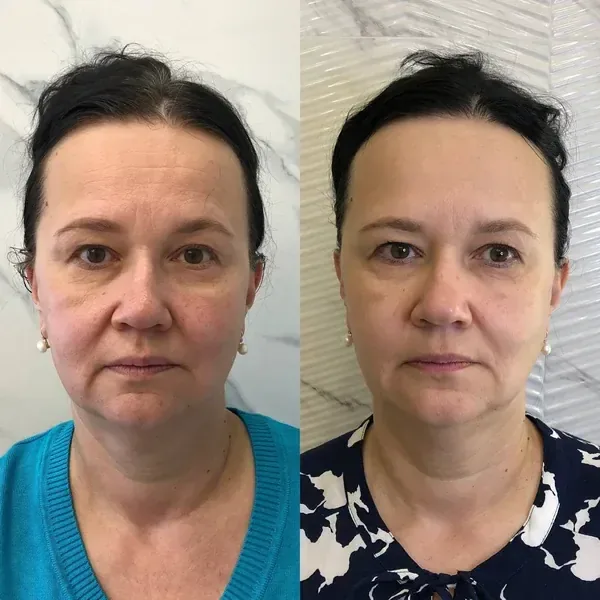 Member before and after