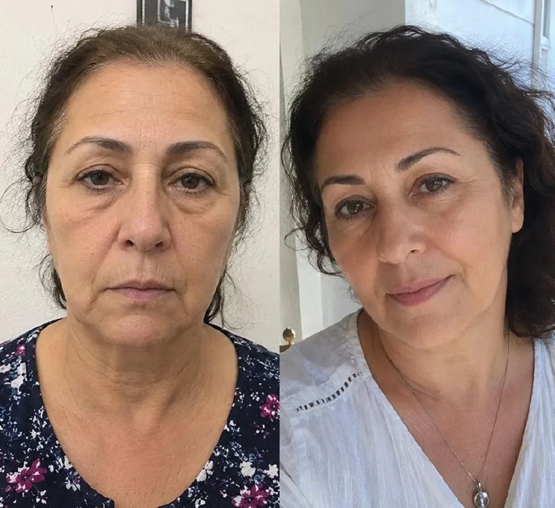 Kulüp üyesi öncesi ve sonrası