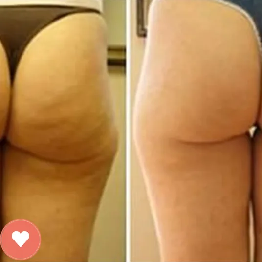 Member before and after