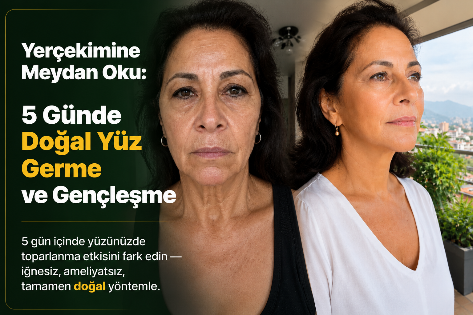 5 Adımlı Yüz Germe — Faceplasty