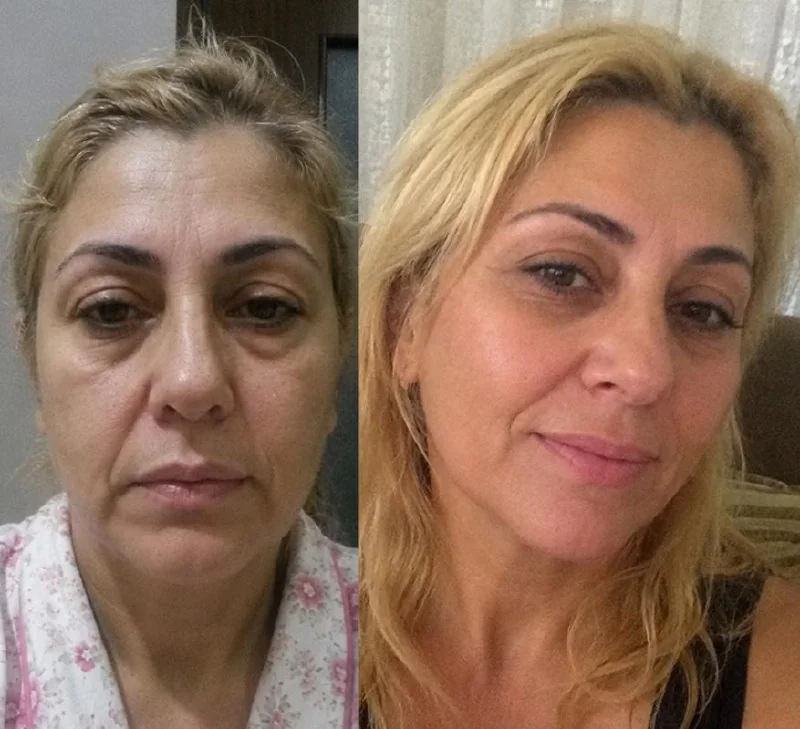 Kulüp üyesi öncesi ve sonrası