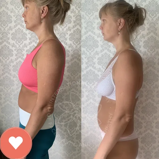 Member before and after