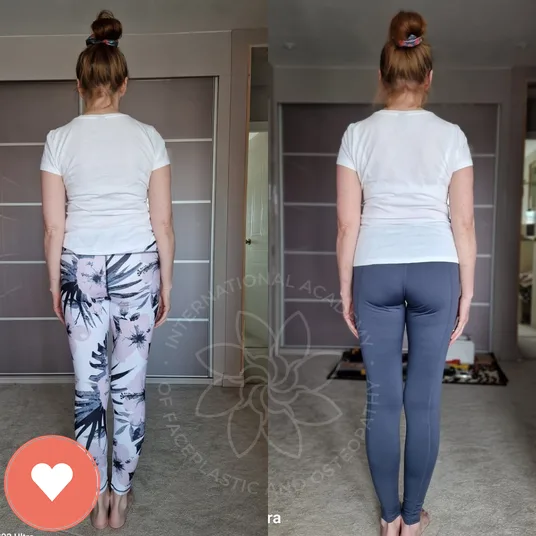 Member before and after