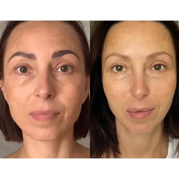 Member before and after