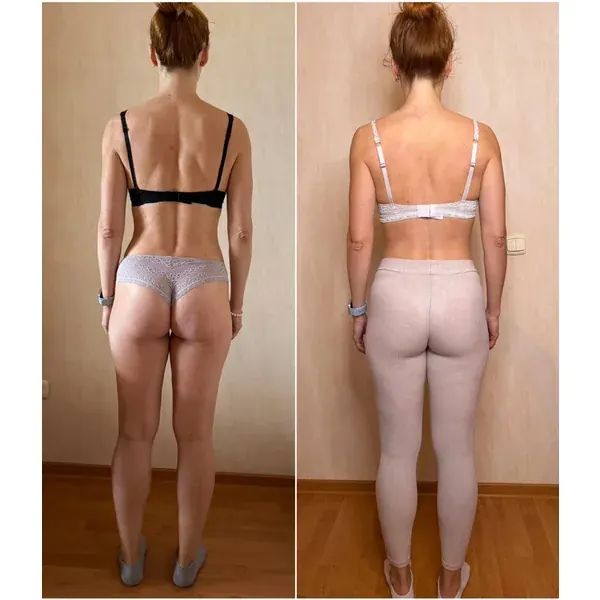 Before and after — lifted glutes