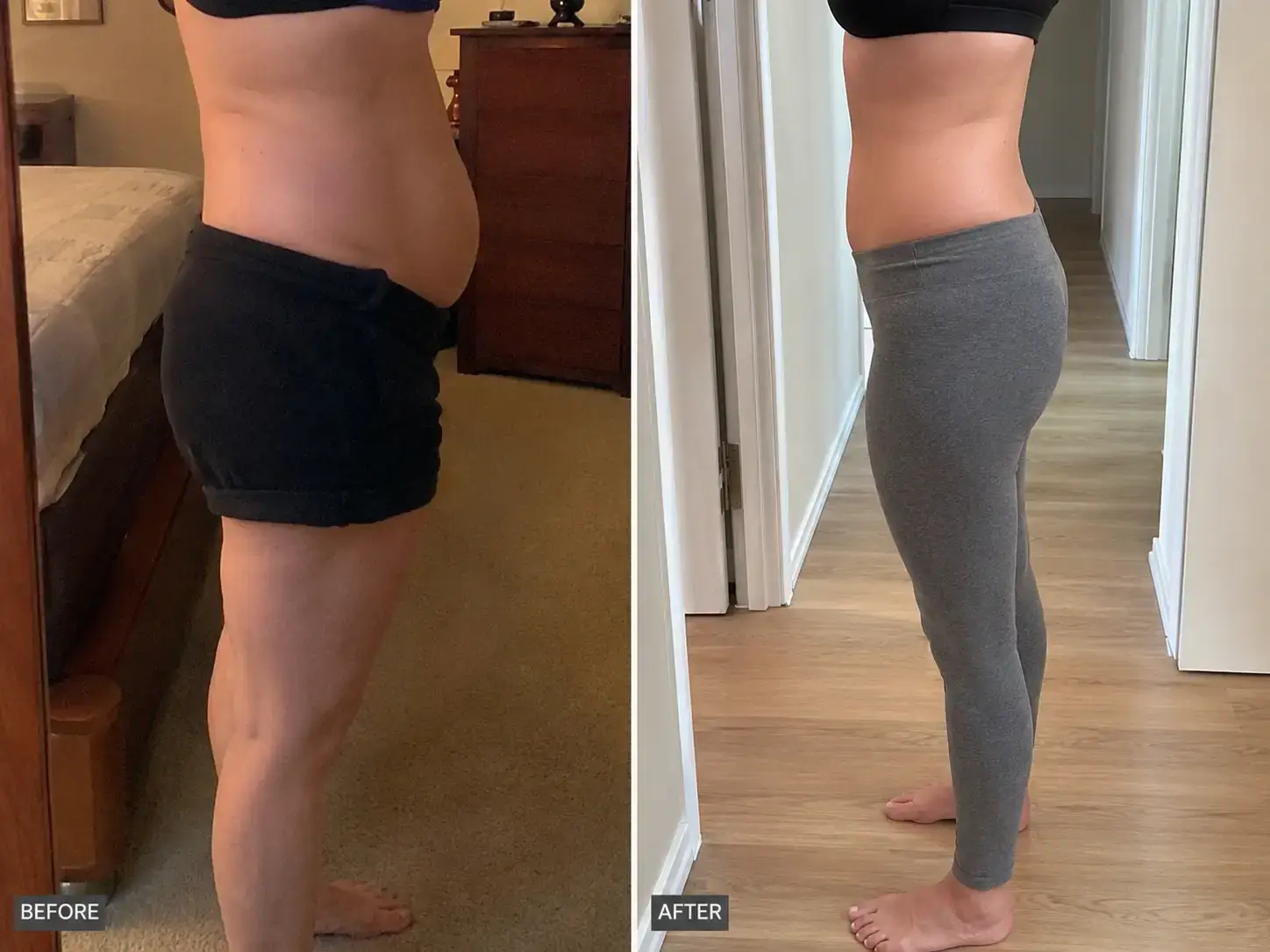 Before and after — flatter belly